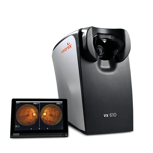 VX 610 — Visionix